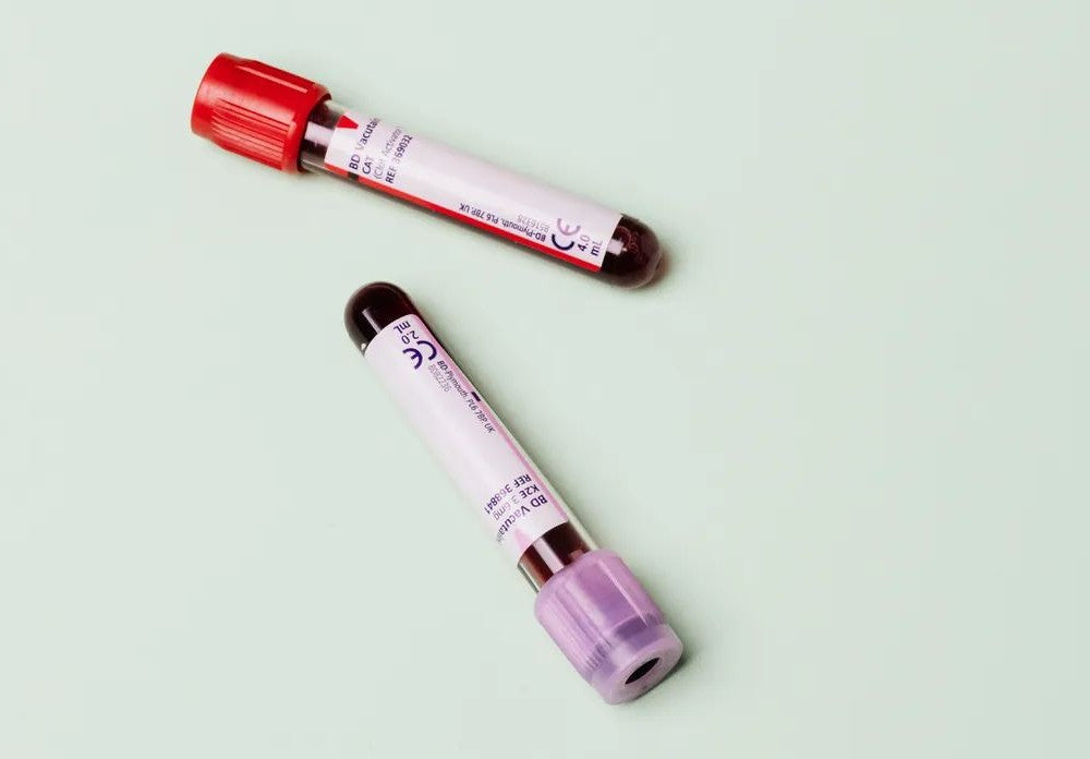 Lab Tests